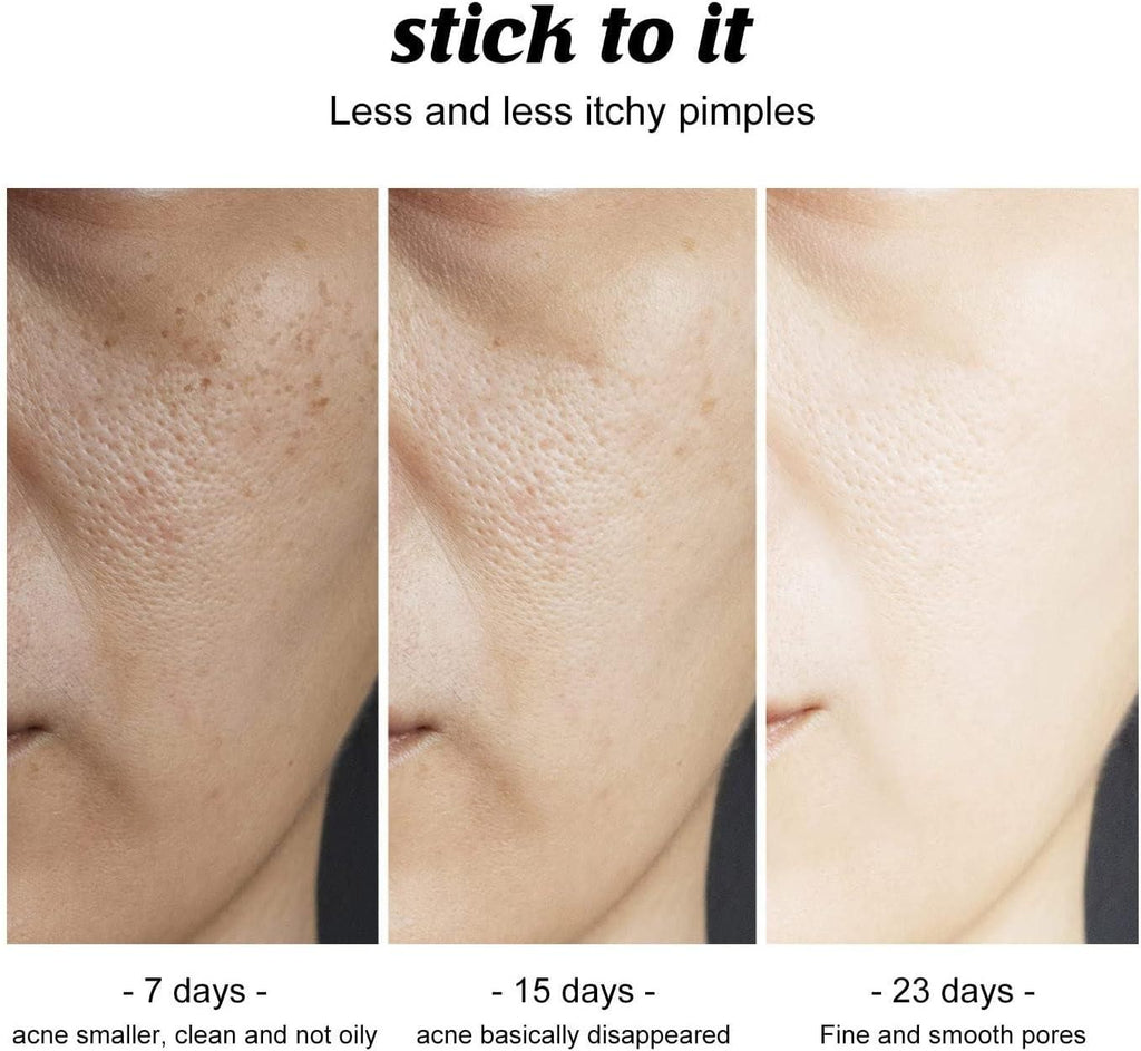 Charcoal Cleansing and Deep Face and Soap Natural Bath Skin